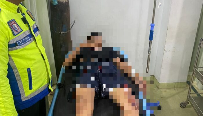 Diduga Kurang Konsentrasi dan Tanpa Helm, Dua Motor Adu Banteng di Sergai, Empat Orang Terluka11